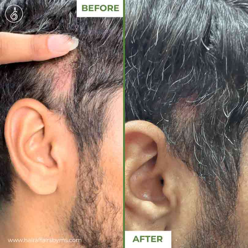 ✨ گھنے بالوں کے لیے ڈرما رول ✨ Derma Roller
💆‍♂️ Hair Growth & Skin Care Solution
